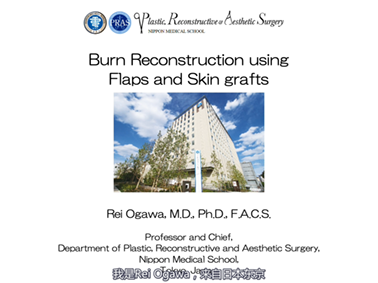 Burn Reconstruction using Flaps and Skin grafts
